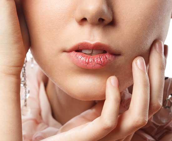 دلایل خشکی دهان چیست و چطور درمان می گردد؟